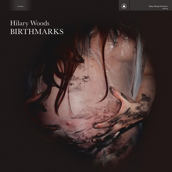 Hilary Woods Birthmarks